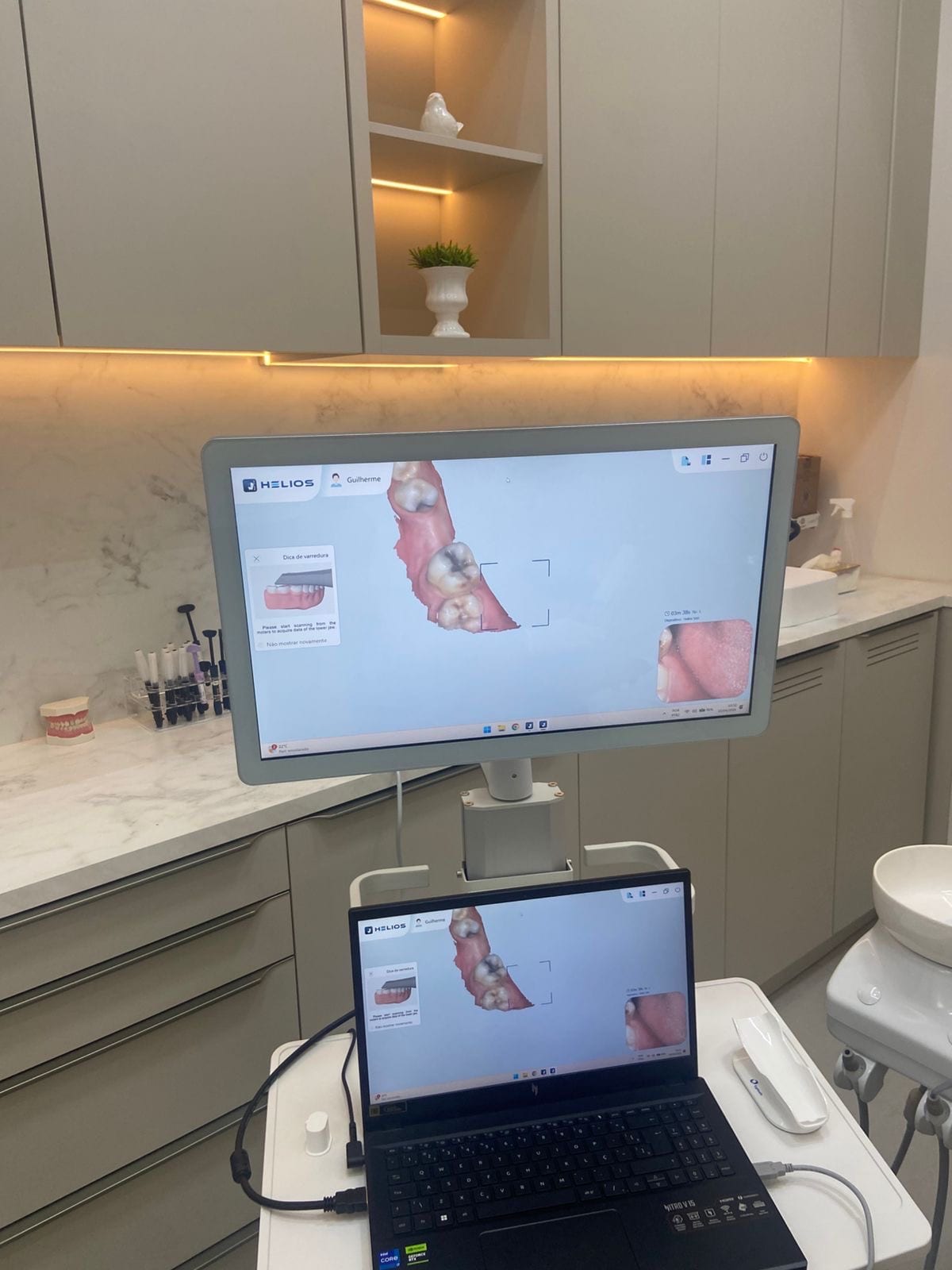 Consultório com scanner intraoral Helios